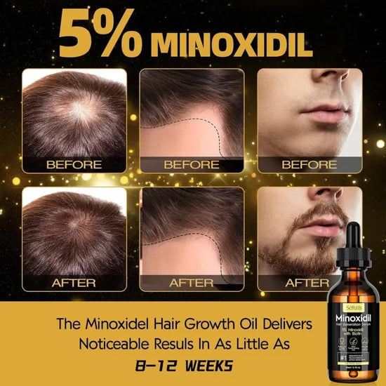 TRAT. CAPILAR MINOXIDIL SEFRALLS 60ML 6PCZ (AMERICANO)